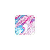 Alcian Blue (pH 1.0) Stain Kit